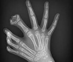 Amazing Radiology Images Radiology Imaging Radiology Radiology Student