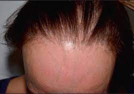We did not find results for: Quand Les Cheveux Se Cassent