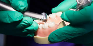 The dental care center is a family dentist serving fayetteville, nc. Dental Alumni Respond News Services Ecu