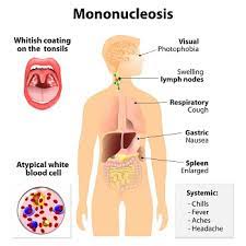 We did not find results for: Treating Mono In Your Child