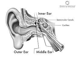 Image result for Bacterial Labyrinthitis
