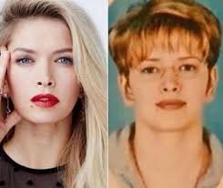 В комментариях к посту актрисы появились вопросы от подписчиков, которые помнят, что асмус развелась с гариком харламовым в конце 2020 года. Vera Brezhneva Do I Posle Plastiki