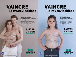 La mucoviscidose est une des maladies génétiques potentiellement graves les plus fréquentes en france et dans les pays occidentaux. L Association Vaincre La Mucoviscidose Organise Sa Journee De Mobilisation