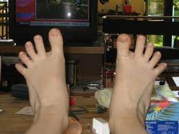 Tweet me for a follow & dm me if. My Smelly Feet By Orlinek On Deviantart