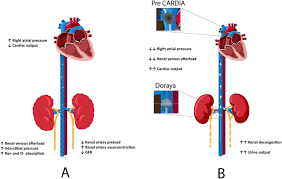 Image result for Afterload
