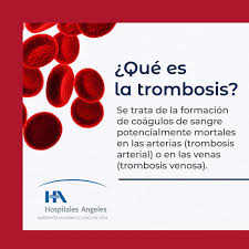 El tratamiento de la trombosis pulmonar se enfoca en evitar que algún otro coágulo tape algún vaso y evitar también las consecuencias de la trombosis pulmonar actual. Hospitales Angeles Na Twitteru Diamundialdelatrombosis Sabias Que Las Principales Consecuencias De La Trombosis Son Infarto Cardiaco Trombosis Pulmonar E Infarto Cerebral Un Diagnostico Oportuno Es Fundamental Para Disminuir Sus Complicaciones