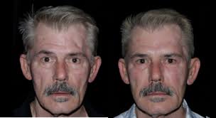 David A. Kimmel, DMD, Dentist