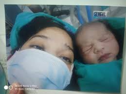 Without BF VS After Six Months with BF