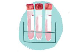 Check spelling or type a new query. Les Analyses De Laboratoire Avant Une Chirurgie Quand Sont Elles Vraiment Necessaires Choosing Wisely Canada