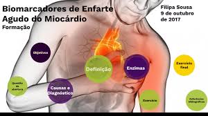 O enfarte agudo do miocárdio (eam), vulgarmente conhecido por ataque cardíaco, é uma emergência médica em que cada minuto conta porque há o risco de o coração parar. Biomarcadores Eam By Lipa Neia