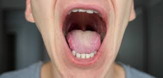 Image result for gums cancer symptoms