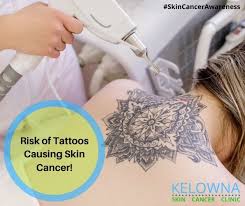 In the united states, it's estimated that doctors diagnose over 100,000 new skin cancer cases each year. Dr Ben Wiese On Twitter Dr Keith Roach Suggests Here That There Is A Little Risk Of Tattoos Causing Skin Cancer Read The Full Report Https T Co Boknm6mhzm Skincancer Skincare Tattoos Skincareawareness Cancer