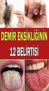 Demir Eksikliginin 12 Onemli Belirtisi Sosyolife Net Dogal Saglik Saglikli Alternatif Saglik