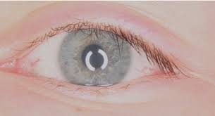 Image result for Scleria globonux