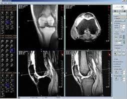 It's a program that let users conveniently access medical data. Jivex Free Dicom Viewer For Windows