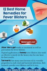 12 Easy And Best Home Remedies For Fever Blisters That Work Home Remedies For Fever Fever Blister Remedy Fever Blister Home Remedy