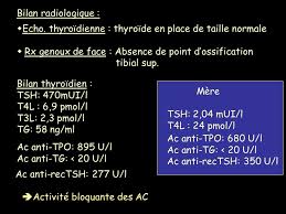 Антитела к тиреоидной пероксидазе, микросомальные антитела, антитела к микросомальному антигену, аттпо, атпо. Pathologie Thyroidienne Ppt Telecharger
