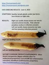 Maryannpack Ear Candling Ear Infection Remedy Ear Health