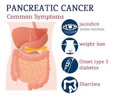 Learn about 14 of the most common pancreatic cancer. Pancreatic Cancer Treatment In Punjab Pancreatic Cancer Treatment Cost In Ludhiana