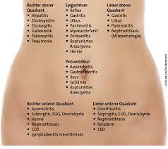 Bauchschmerzen Systematisch Abklaren Doctors Today