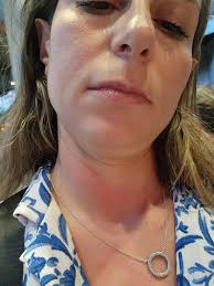 סטלה ויינשטיין Stella Weinstein