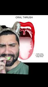 Gwendolyn Mouth Thrush