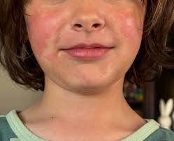 Hey all! I forgot my markers