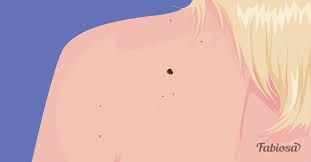 Today, a very topical issue is the treatment of cancer. Which Type Of Skin Cancer Is The Most Dangerous How It Develops And How To Lower Your Risk
