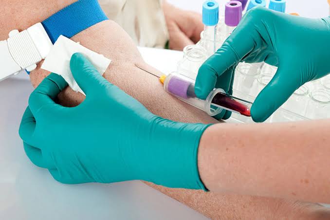 Phlebotomist vs Phlebotomy Technician: Which Is Best? | Phlebotomy USA