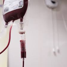 Image result for Plasma Transfusion