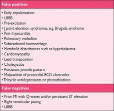 Third Universal Definition Of Myocardial Infarction Circulation