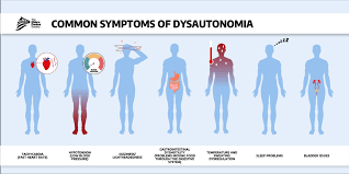 Image result for Autonomic Dysfunction