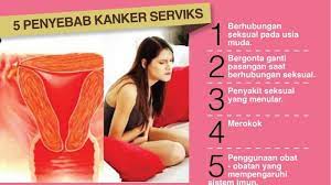 Kanker serviks (cervical cancer) atau kanker mulut rahim? Ms V Berdarah Tanpa Sebab Begini Gejala Kanker Serviks Yang Terkadang Tak Disadari Wanita Bangka Pos