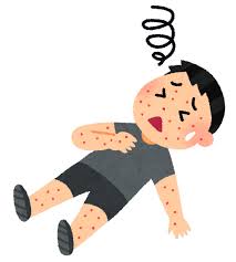 アナフィラキシーのイラスト | かわいいフリー素材集 いらすとや