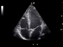 Ultrasound is often one of the first line tests in the detection of cancer. Medical Ultrasound Wikipedia