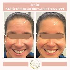 Mallorie Dammeyer, APRN