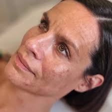 Faces Aesthetics And Beauty