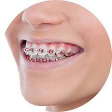 Dis Teli Renkleri Anlamlari Ve 7 Muhtesem Kombinasyon