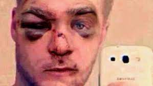 Hombre Es Brutalmente Golpeado Por Maltratar A Su Perro Video El Grafico Historias Y Noticias En Un Solo Lugar