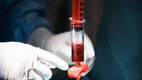 Image result for why are people going to russia for ms treatment