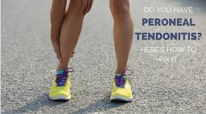Inflammation of the tendon causes pain when the muscle is stretched or contracted, and when the treatment of lower leg pain. Do You Have Peroneal Tendonitis Here Is How To Fix It Runners Connect