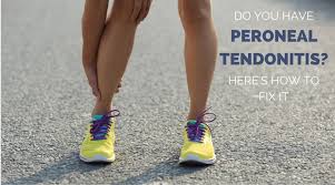 Where are the tendons in your upper legs. Do You Have Peroneal Tendonitis Here Is How To Fix It Runners Connect