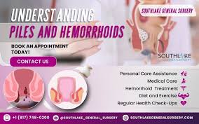 Image result for Hemorrhoid