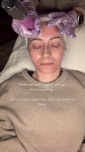 ✨ Microneedling: What to Expect ✨ New here? We've got you 🤍 • Numbing  cream for comfort • Light redness after (like a mild sunburn) • Minimal  downtime (24–72 hrs) • Smoother,