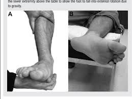 Image result for Ankle External Rotation Test