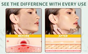 Amazon.com: WHLH & WELL-BEING Beef Tallow for Skin, Beef Tallow and Honey  Balm, All-Natural Ingredient Moisturizer for Face & Body Skin Care 1Pack :  Beauty & Personal Care