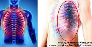 It is formed by the 12 thoracic vertebrae, 12 pairs of ribs and associated costal cartilages and the sternum. Pin On Health