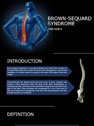 Brown Sequard Syndrome Spinal Cord Injury Spinal Cord