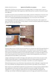 Nei bambini di età compresa tra 3 e 6 mesi limitare la somministrazione a quelli di peso superiore ai 5,6 kg. Approccio Al Bambino Con Porpora Miniero Studocu