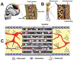 Create a graphic representation of a long bone using powerpoint. Bone Defect Model Dependent Optimal Pore Sizes Of 3d Plotted Beta Tricalcium Phosphate Scaffolds For Bone Regeneration Small Methods X Mol
